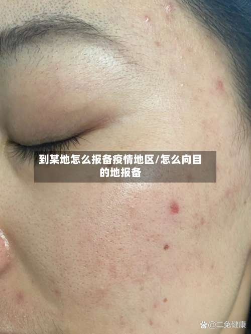 到某地怎么报备疫情地区/怎么向目的地报备-第1张图片
